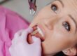 decayed teeth removal